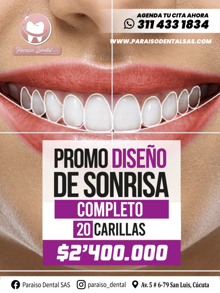 PROMO 14