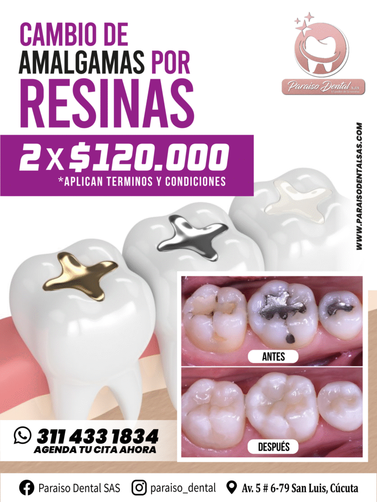 PROMO 5